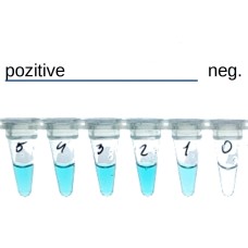 RT-LAMP Assay Colorimetric Kit (LAMP Kit)