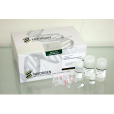 Viral Nucleic Acid Extraction Kit, (With Carrier RNA, for low viral load specimen using carrier RNA)